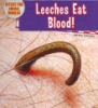 Leeches_eat_blood_