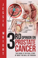 3rd_Opinion_on_Prostate_Cancer