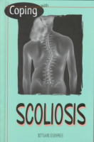 Coping_with_scoliosis
